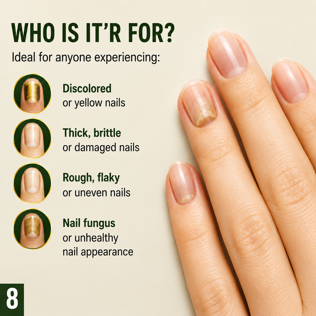 7 Days Nail Fungus Solution with Ginger Extract – 2.02 Fl Oz