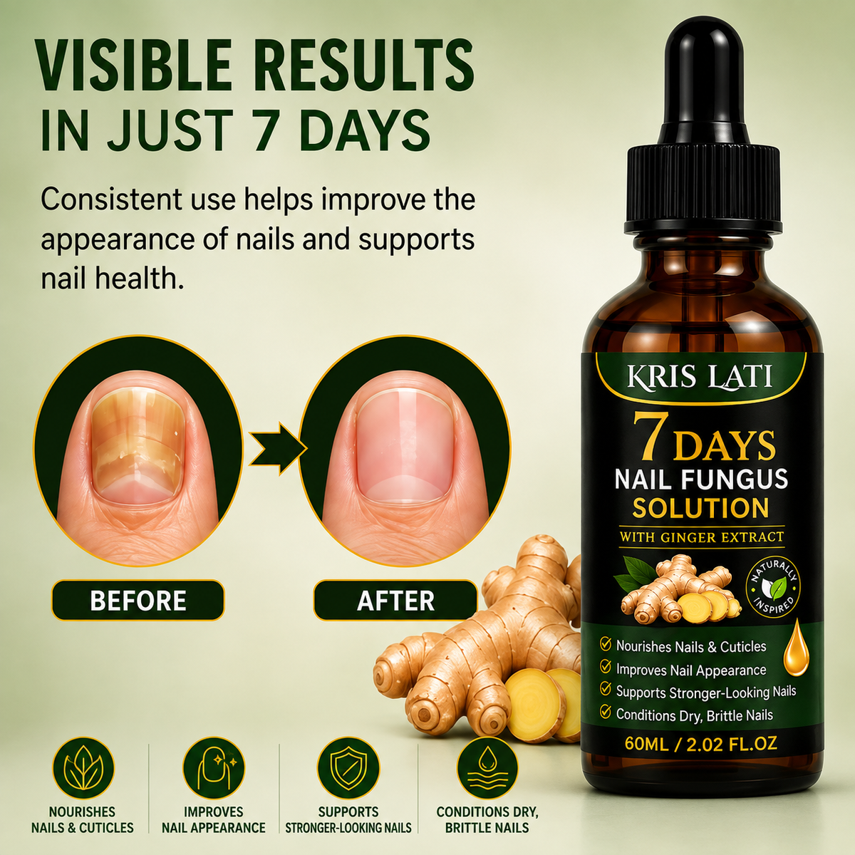 7 Days Nail Fungus Solution with Ginger Extract – 2.02 Fl Oz